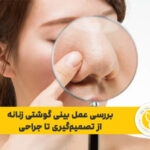 بررسی عمل بینی گوشتی زنانه از تصمیم‌گیری تا جراحی