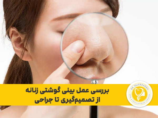 عمل بینی گوشتی زنانه